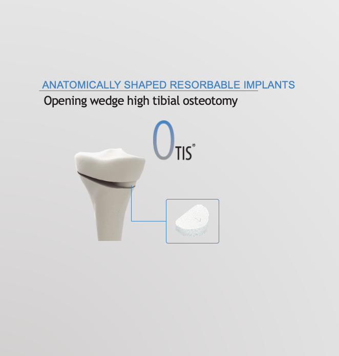 Opening wedge high tibial osteotomy